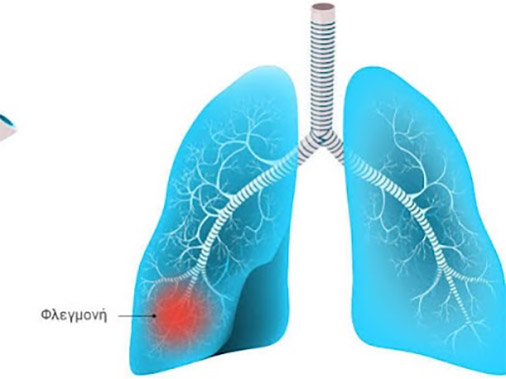 Παγκόσμια ημέρα πνευμονίας